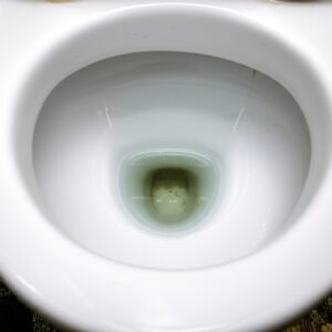 5+ Cách Xóa Vết Két Trong Nhà Vệ Sinh Cứng Đầu Nhất – Hướng Dẫn Từ Chuyên Gia